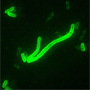 yersinia